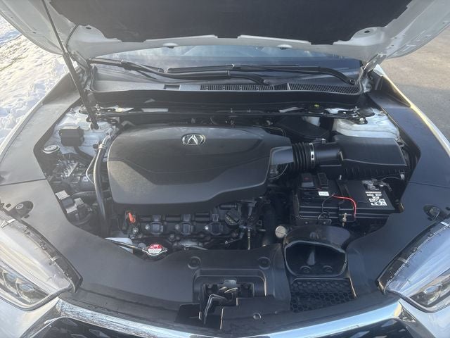 2018 Acura TLX 3.5L V6 w/Technology Package