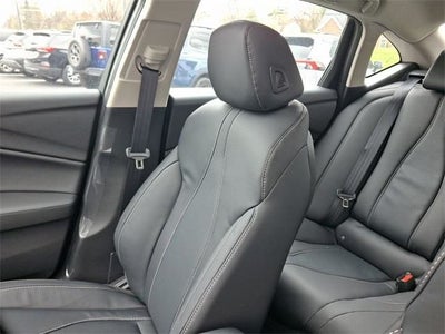 2025 Acura TLX Technology Package