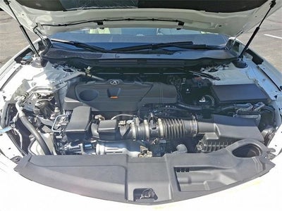 2025 Acura TLX Technology Package