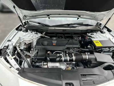 2025 Acura TLX A-Spec Package SH-AWD