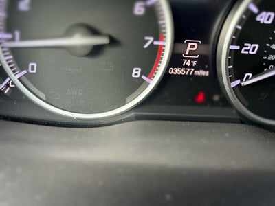 2017 Acura RDX Advance Package